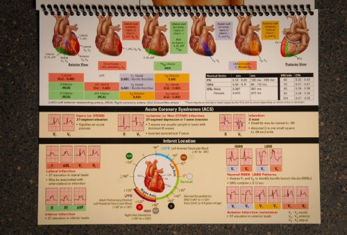 Hospital Stat EKG 12-Lead (Stat Medical Education 12 Lead) Hospital Stat EKG 12-Lead (Stat Medical Education 12 Lead)