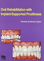 Oral Rehabilitation With Implant-Supported Prostheses 086715358X Book Cover