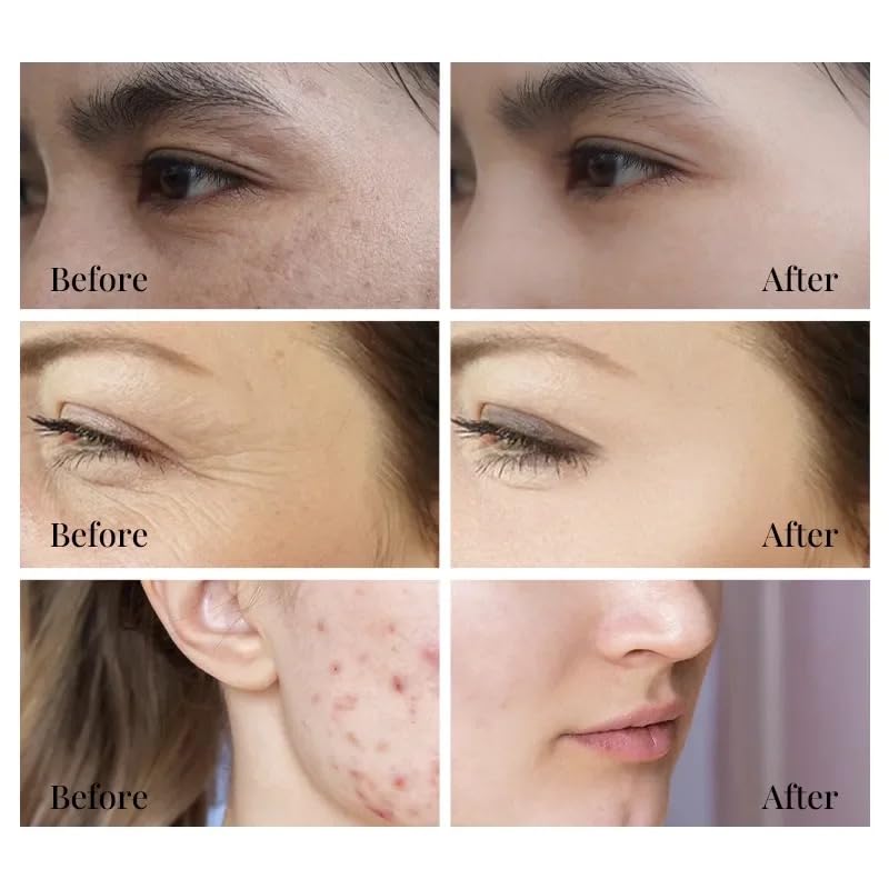 Miniatura 4 de Glammius Snail Repair Serum con filtrado de caracol, retinol y aceite de ricino (antienvejecimiento) 1.7 oz (1.7 fl oz)