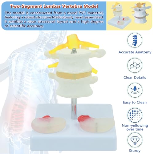 Image of 2 Section Lumbar Intervertebral Disc Human Skeleton Spine Model,Anatomical Vertebrae Model for Chiropractic,Patient Education Demonstration,Excellent Way for Demonstrating Disc
