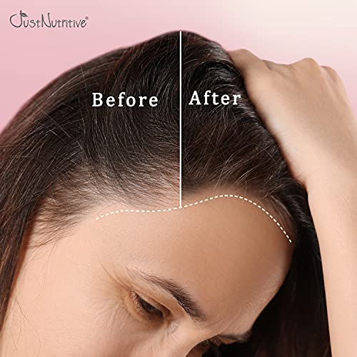 Adult Women's Hair Treatment | Hair Loss Treatment | Hair Loss Regrowth for Thinning Hair | Hair Growth Product | Just Nutritive | 4 Oz - Thumbnail 7