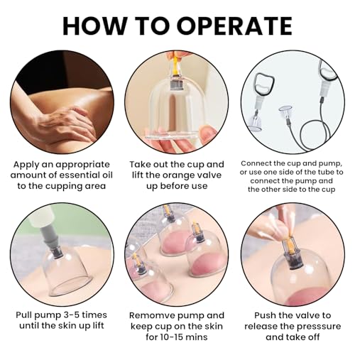 Image of HIJAMA Cupping Kit 12 Pcs Vacuum Cupping Set for Health Care Portable Body Relaxation Massage and Manual Therapy Cups for Pain Relief Magnetic Traditional Chinese Therapy Cupping