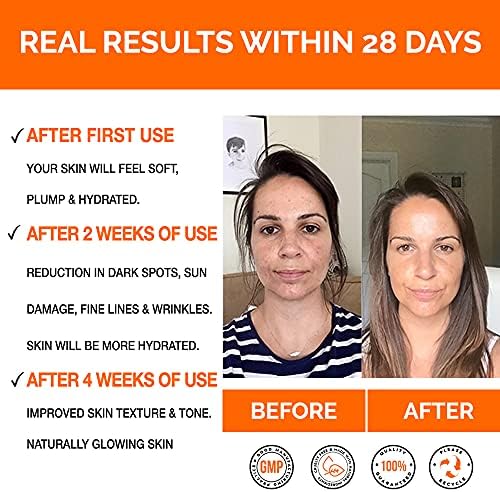 Vitamin C Serum For Face with Hyaluronic Acid Serum - Anti Ageing & Anti Wrinkle Serum - Customers Call It A Face Lift without the needles! This Vitamin C Serum Will Plump, Hydrate & Brighten. Skin Care to Over 500,000+ Happy Face Serum