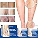 yetary 2 Pcs Varicose Veins Cream for Legs, Spider Varicose Veins ReliefCream, SkinCream for Legs, Cream for VaricoseVeins