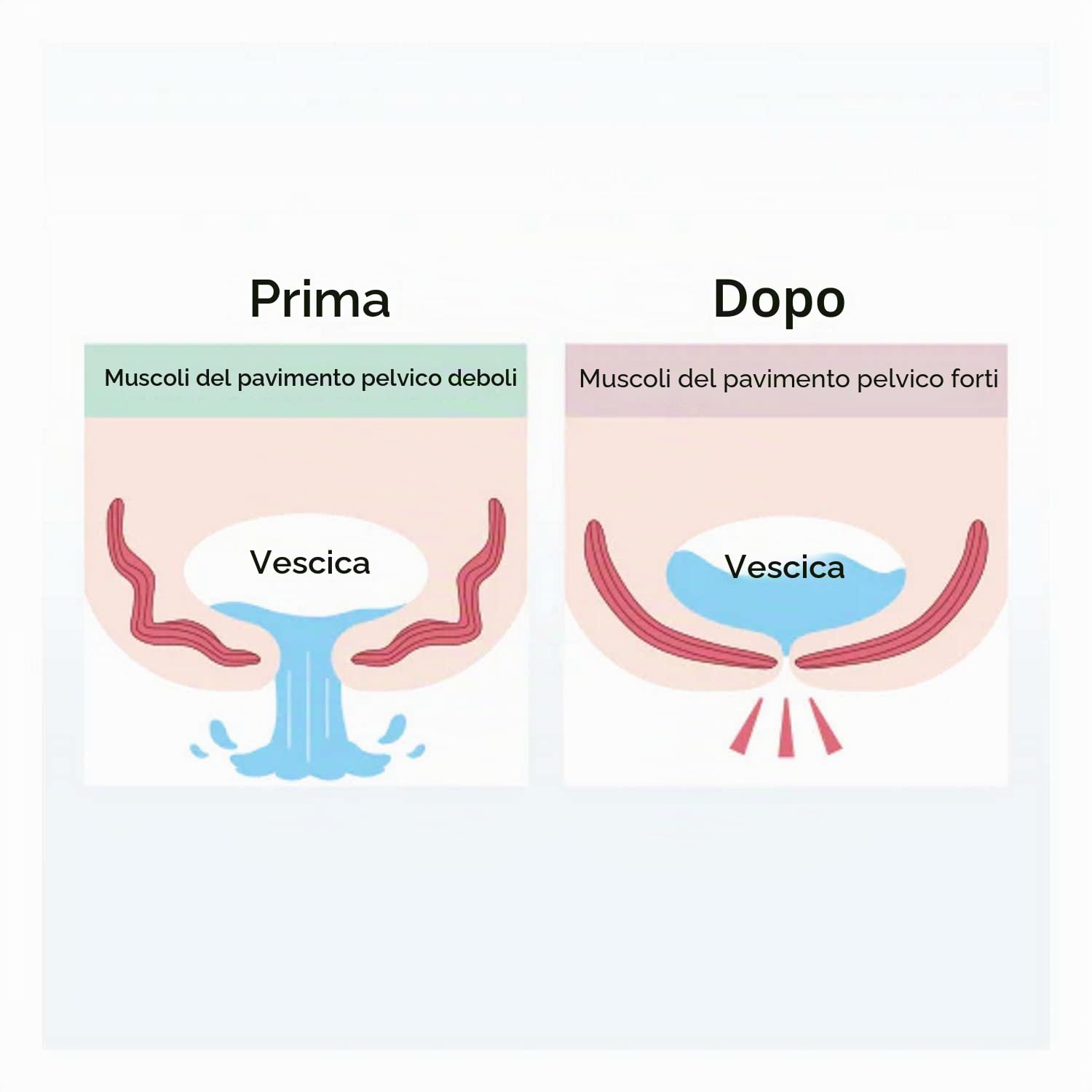 MYTREX Aqua Qutto Esercitatore Pavimento Pelvico Femminile | Dispositivo di Allenamento Muscolare del Pavimento Pelvico. Rinforzante e Riabilitante Impermeabile per Donne.
