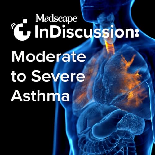 『Medscape InDiscussion: Moderate to Severe Asthma』のカバーアート