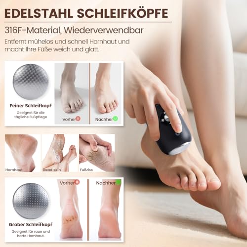 zwei Geschwindigkeitsstufen einstellbar - Detailansicht von FIVAVA Hornhautentferner Elektrisch Deal – Dealfoxx.de