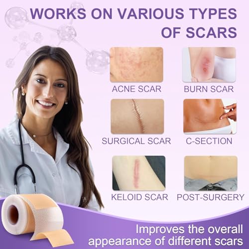 Image of Silicone Scar Sheets, Advanced Medical Silicone Scar Tape(1.6 inchx 60 inchRoll-1.5M), Professional Grade Scar Removal Strip for Surgery, Tummy, Mouth, Face, C Section, Burn, Keloid, Acne Scars etc