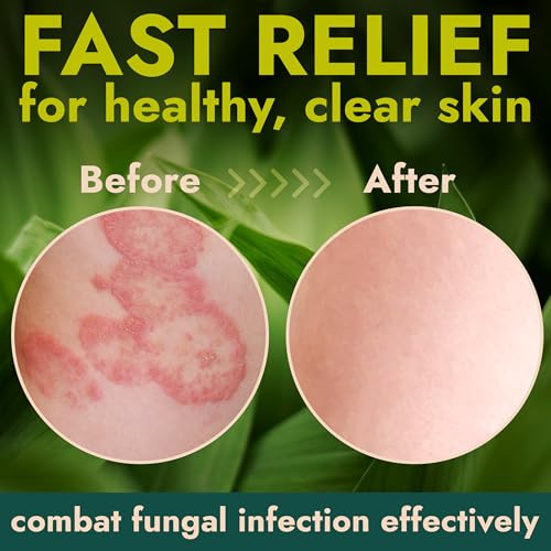 Image of Antibacterial Body Lotion Kills 99.9% of Germs, Bacteria & Sanitizes Skin