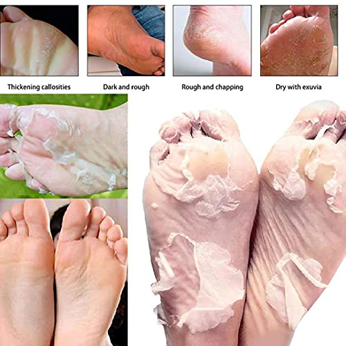 Voetverzorging, 3 Pack Foot Peel Face-Cover Callus Dode Huidcellen Remover Exfoliator Moisturizing Whitening Baby Zachte… - Image 5