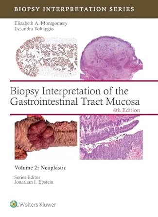 Biopsy Interpretation of the Gastrointestinal Tract Mucosa Volume 2: Neoplastic: eBook without Multimedia (Biopsy Interpretation Series) - img