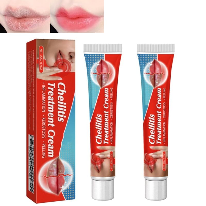 Lip Balm, Lip Lightening For Dark Lips, 20g Lip Balm Moisturizing, Lightening balm for Men and Women Moisturizer Essence, Moisturizing Brighten Lip Care Mask (2pcs)