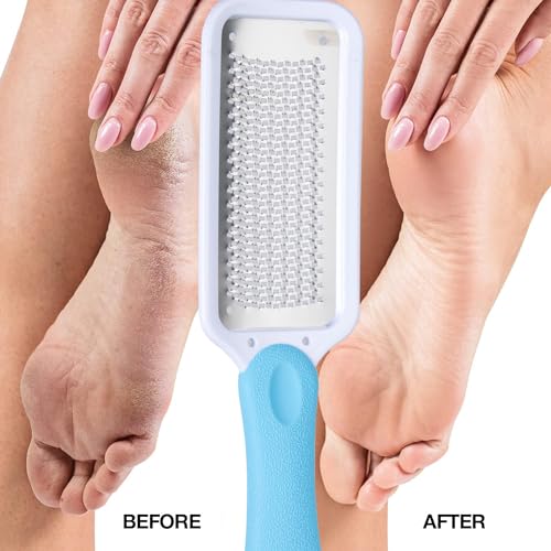 Foot File Feet Hard Skin Remover Foot Scraper Foot Files Foot Grater Foot exfoliator for Wet Dry Dead Rough Skin Dry Cracked Feet Foot Care - Image 5