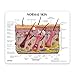 GPI Anatomicals - Skin Acne Model, Cross-Section Showing Normal and Common Acne-Riddled Skin for Human Anatomy, Physiology Education, Anatomy Model for Doctor's Office, Medical Learning Resources
