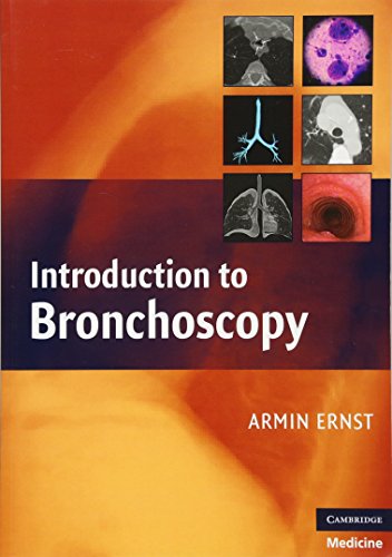 Introduction to Bronchoscopy view 2