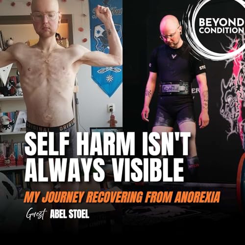 Page de couverture de Self Harm Isn't Always Visible | My Journey Recovering From Anorexia Guest. Abel Stoel