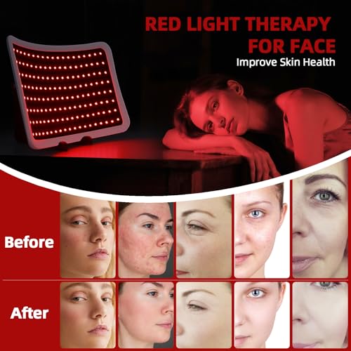 Image of Red Light Therapy Device - 660nm Red & 850nm Infrared LED Therapy Lamp for Face and Body, Versatile Design with Stand, Legs & Strap, Well-Made and Easy to Use(White)