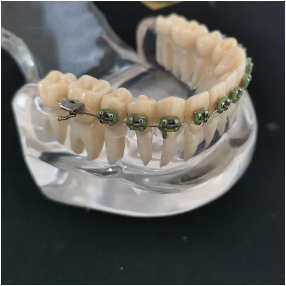 Model do nauczania zębów, model korekcji ortodoncji, model zębów dentystycznych, model ortodontyczny, przezroczysty model zębów dentystycznych z drutem łukowym - do nauki nauczania