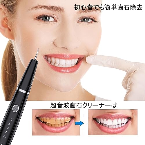 Micfendy 超音波歯クリーナー 口腔洗浄器 の商品画像 1