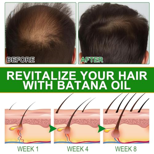 Batana-Oil-for-Hair-Growth-Hair-Treatment-Serum-CapsulesRaw-Batana-Hair-OilNo-Rinse-Hair-Vitamin-Serum-for-Dry-Damaged-HairHair-Treatment-Leave-in-Anti-Frizz-Conditioner-Vitamins-A-E-Pro-B5