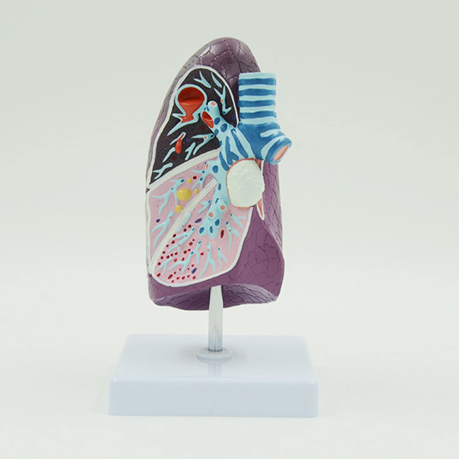 Modelo De Pulmón Humano, Estructura De Pulmón Humano Enfermo Modelo De Sistema Respiratorio para Estudios Anatómicos Pantalla Ensatomía Anatomía Suministro Y Equipo Médico