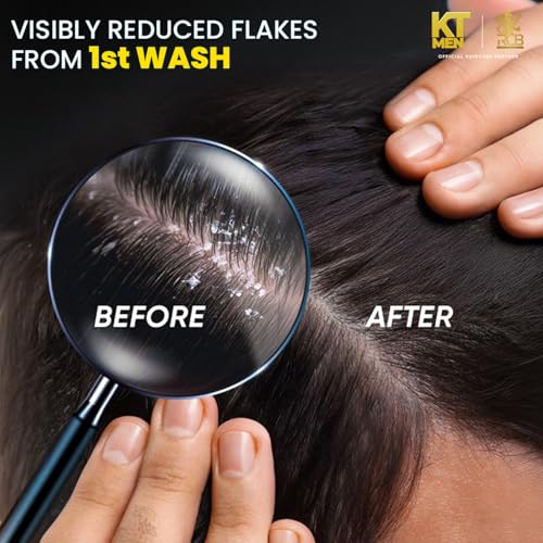 Image of Anti-Dandruff Lock Control Conditioning Shampoo | Flake-Free Scalp | Deep Cleansing + Dandruff Control | Plant-Based Keratin Protein- (RCB) | 200ml