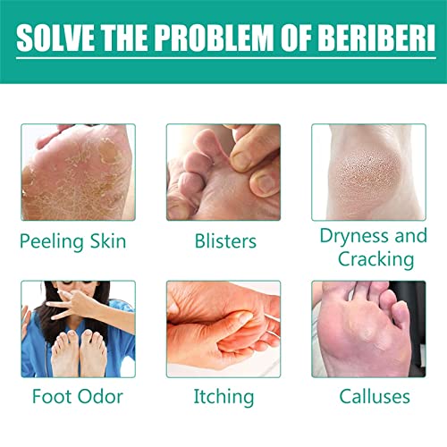 Foot Deodorant Spray,Foot Spray Odor Eliminator Spray,Herbal Foot Peeling Spray,Fungal Combat Feet Spray,Keep Fresh&Dry For A Long Time #TOP4