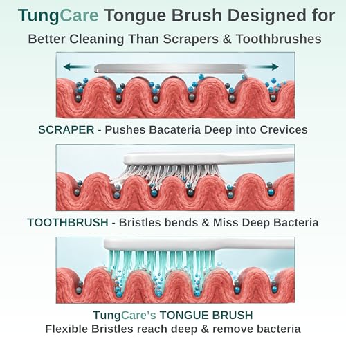 Image of Tongue Cleaning Gel + Brush Combo for Bad Breath Control | With Zinc | Removes Tongue Residue | Fresh Breath | Maintain Oral Hygine | Cool Fresh | 80g | Gel + Brush | NOTE: Brush Color May Vary