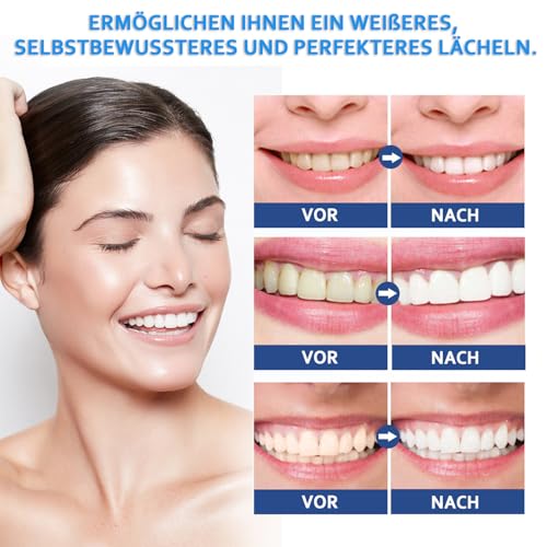 Melarqt Whitening Pen – Zahnaufhellungsstift für effektive Bleaching