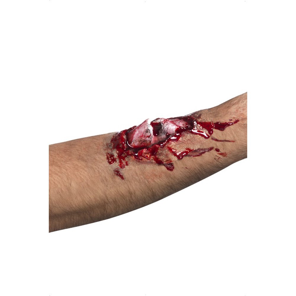 Broken Bone Scar