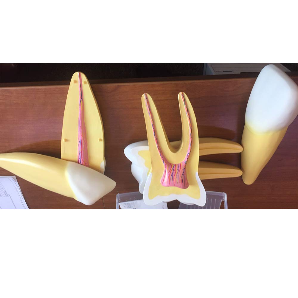 Buy TDOUBEAUTY Teeth Teaching Educational Model 12 Times Incisor ...