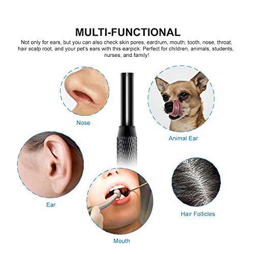 Eutuxia Endoscópio de limpeza de ouvido com luz LED e ferramenta de remoção de cera de ouvido Adequa