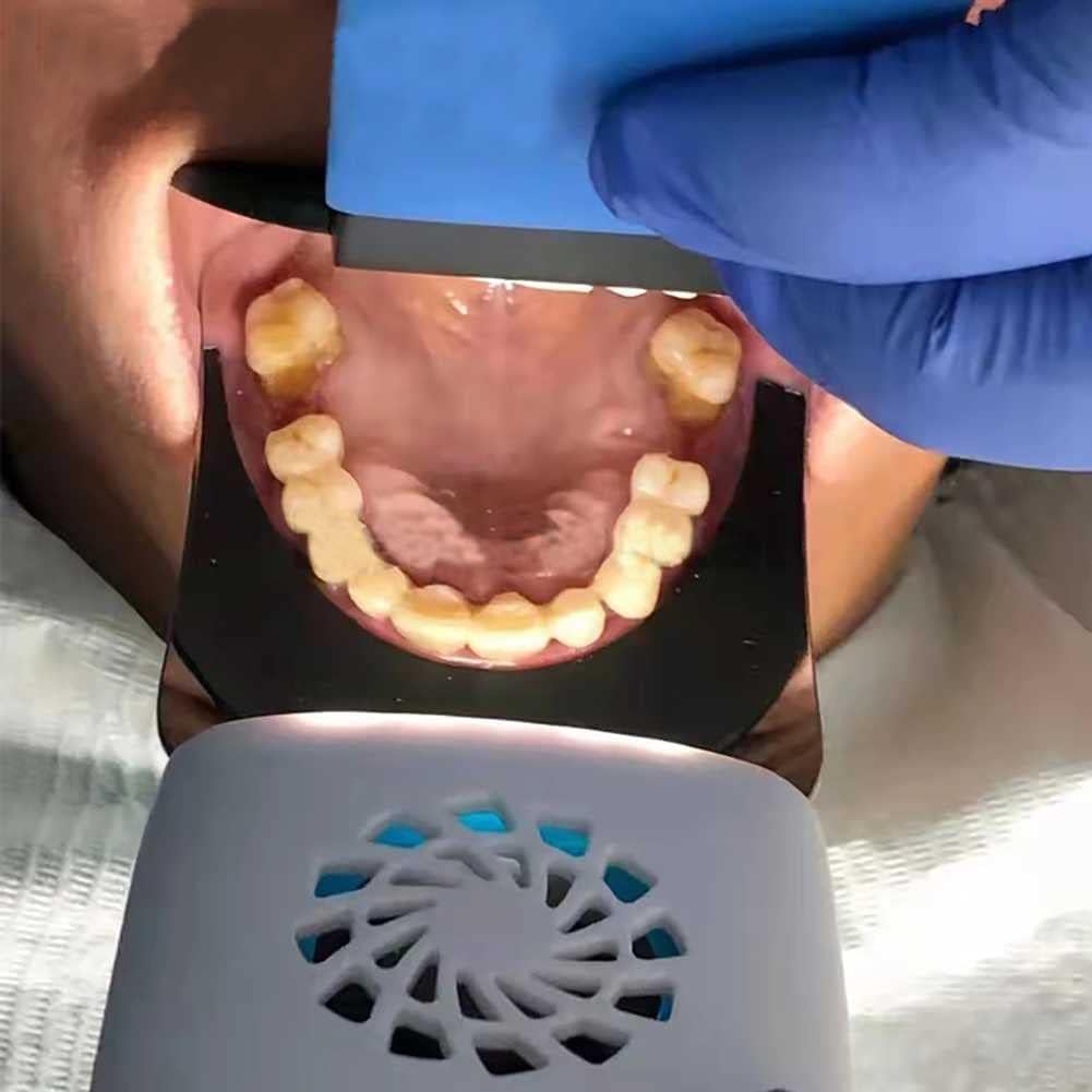 LED-Kieferorthopädie-Spiegel, doppelseitiger Dentalreflektor, Intraoralspiegel mit Lichtgriff, Zahnarzt-Mundpflegewerkzeug