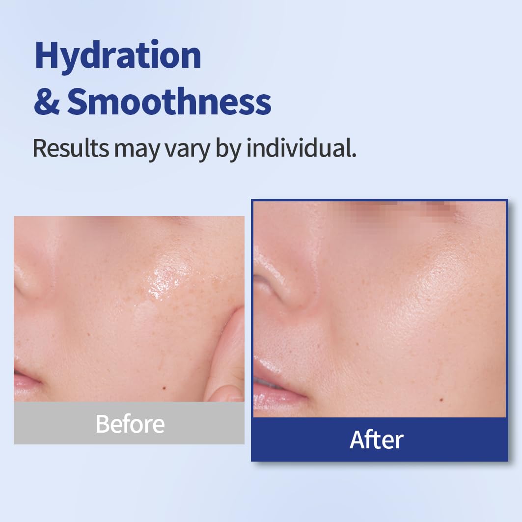 Amazon.com: 1.618 Hyaluronic Acid Ampoule Toner 6.7 Fl oz, Deep