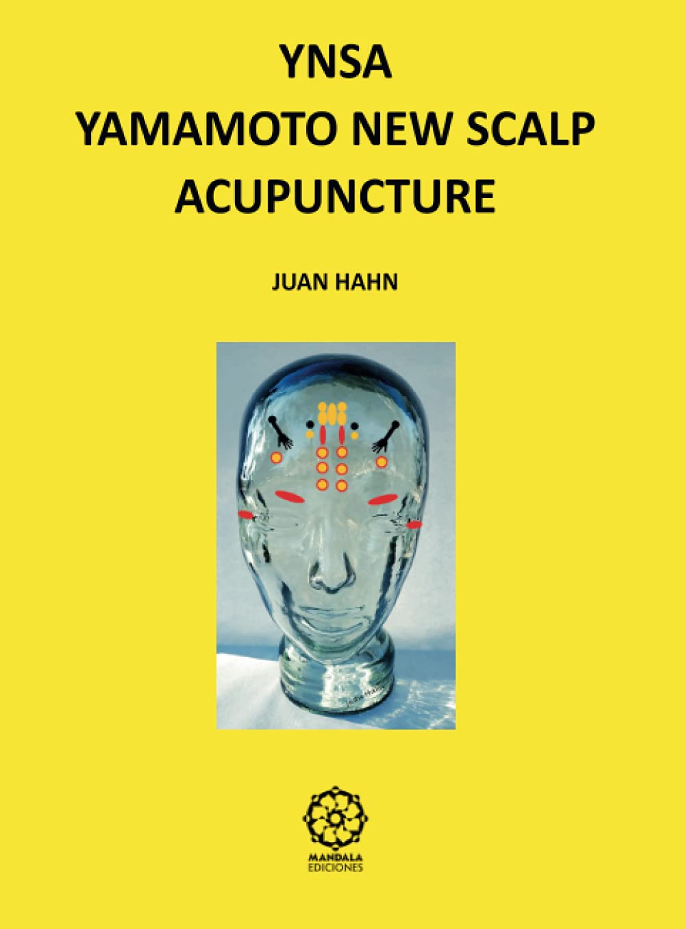 Scalp acupuncture Yamamoto YNSA