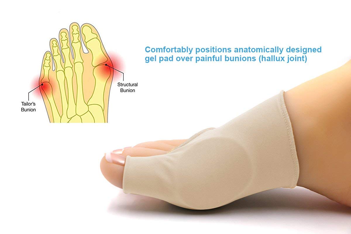 Pedimend - 2 paia di cuscinetti per alleviare il dolore, per alluce valgo, protezione per le dita dei piedi, separatore in gel per il piede, correttore per alluce valgo, cuscinetto in gel per artrite