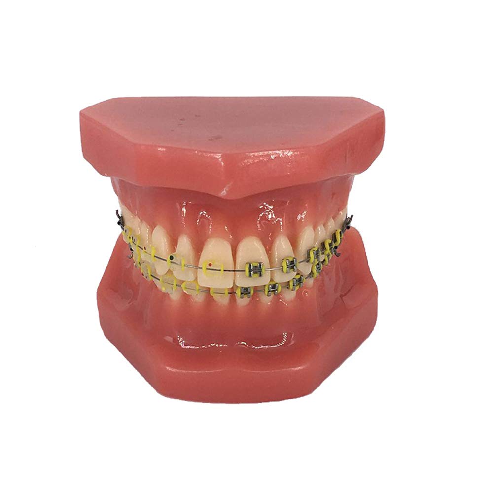 Model ortodontyczny zębów zębów z metalowymi i ceramicznymi modelem doustnym dla dentysty do komunikowania się z pacjentami, studiowanie narzędzia dydaktycznego