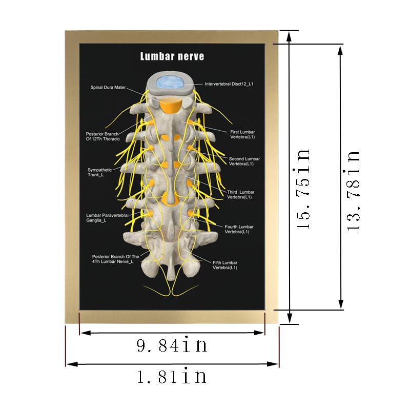 Image of Taanfu Body Educational Learning Anatomy Posters ，Lumbar nerve Art Lumbar Villi Anatomy Art Poster Digestive System Organs Illustration Small Intestine Physiology Anatomy Wall Art Villi