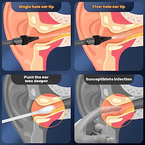 Ear-Wax-Removal-Electric-Ear-Cleaner-Ear-Cleaning-Kit-Ear-Irrigation-Kit-Safe-Ear-Irrigation-Flushing-System-with-4-Pressure-Settings-Effective-Ear-Wax-Removal-Tool-for-Earwax-Buildup
