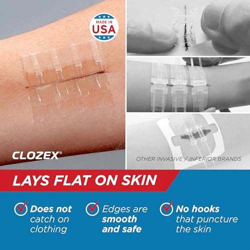 clozex emergency laceration closures - repair wounds without stitches skin closure device for 3 individual wounds or combine for total length of 4 14 inches