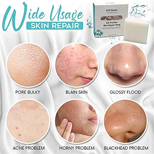 Silk Protein Skin Repair Soap for Tik Tok, Goats Milk Brushed Wire Mesh Oil Control Cleansing and Removal Soap, Skin… - Image 8