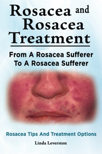 Rosacea and Rosacea Treatment. From A Rosacea Sufferer To A Rosacea Sufferer. Rosacea Tips And Treatment Options