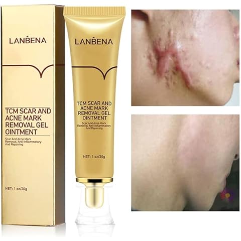 AKARY Herbal Acne Scar Cream Cover