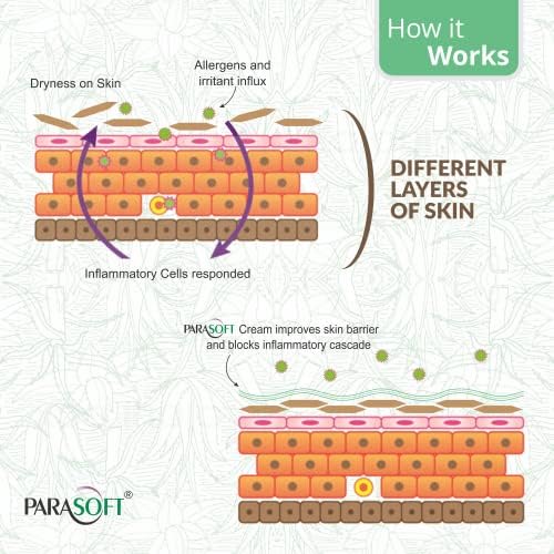 Image of Parasoft Moisturizing Cream with Aloe Vera - 200g (Pack of 8) | Deep Hydration Intense Moisturizer for Dry & Dehydrated Skin, Non-Greasy, All-Season Daily Skincare, Dermatologist Tested, Paraben-Free