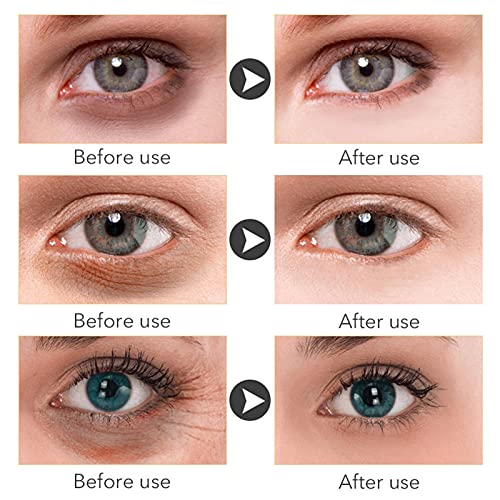 Mimei 30ml natuurlijke fijne lijnen oogcrème anti veroudering effectieve onmiddellijke rimpel Corrector veilige oog… - Afbeelding 5