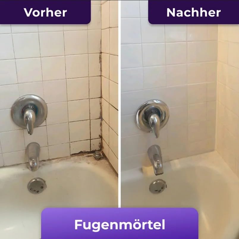Nuroclean Mold Remover Gel(1 Stück)