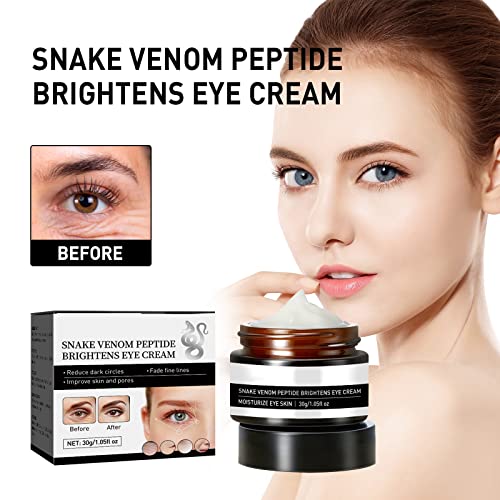 2Pcs Verfons Firming Eye Cream, Jaysuing Collagen Boost Anti-Aging Serum Firming Eye Cream, Verticalox Temporary Firming Eye Cream, Barenkul Temporary Firming Eye Cream #TOP1
