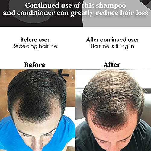 B THE PRODUCT High Potency Biotin Hair Growth Shampoo & Conditioner Set - Fortified with Vitamins E, A, C & B for Fastest Hair Growth (8.5oz.) - Thumbnail 5