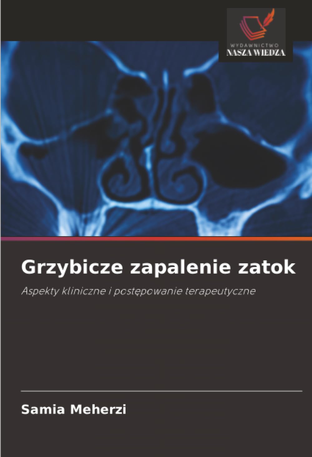 Grzybicze zapalenie zatok: Aspekty kliniczne i post¿powanie terapeutyczne