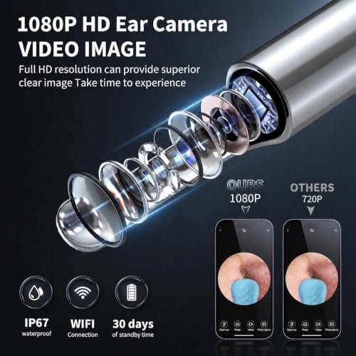 Image of Yorsfun Ear Wax Removal Kit with Camera, Otoscope with 7 Ear Spoon | 1080P HD ear cleaner, 6 LED lights, 7 ear spoons, 6 ear tips, works with iOS and Android